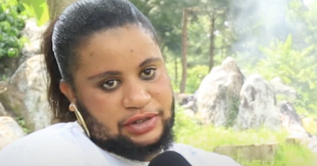 Woman with beards reveals why men avoid dating her