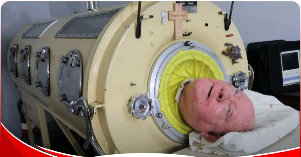 Man who spent 70 years inside an iron lung dies at