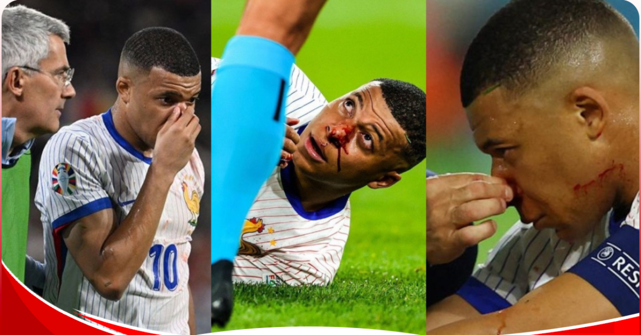 Euro 2024:Kylian Mbappe suffers a broken nose and is shown a yellow card in the process