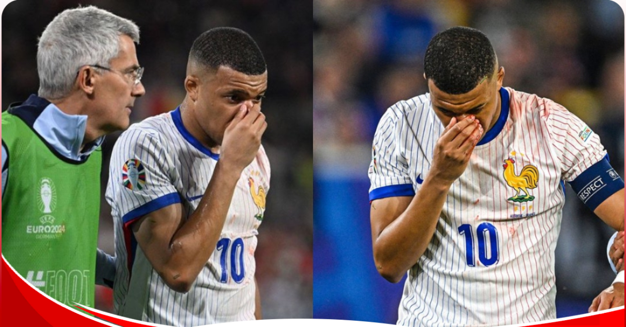 Mbappe likely to wear a mask for the rest of the 2024 Euro competition