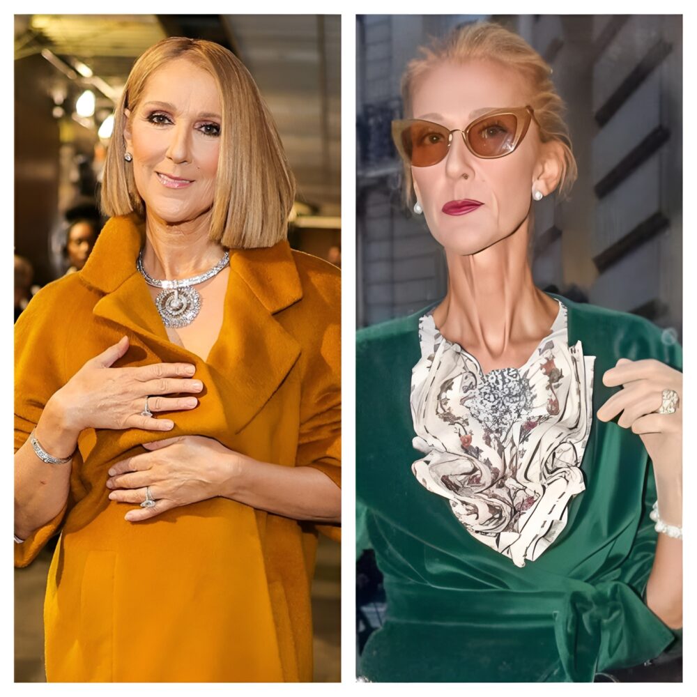 Celine Dion’s intimate, viral video shows painful reality of life-altering illness
