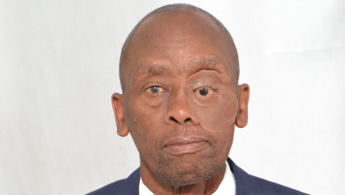 Health milestone: KNH fits Kenya’s first public orbital-facial prosthesis, restoring cancer survivor’s face