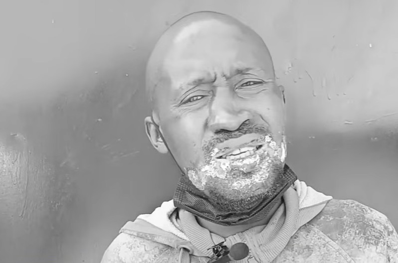 Jamaa achomwa ndevu akiwa amelala klabuni Machakos