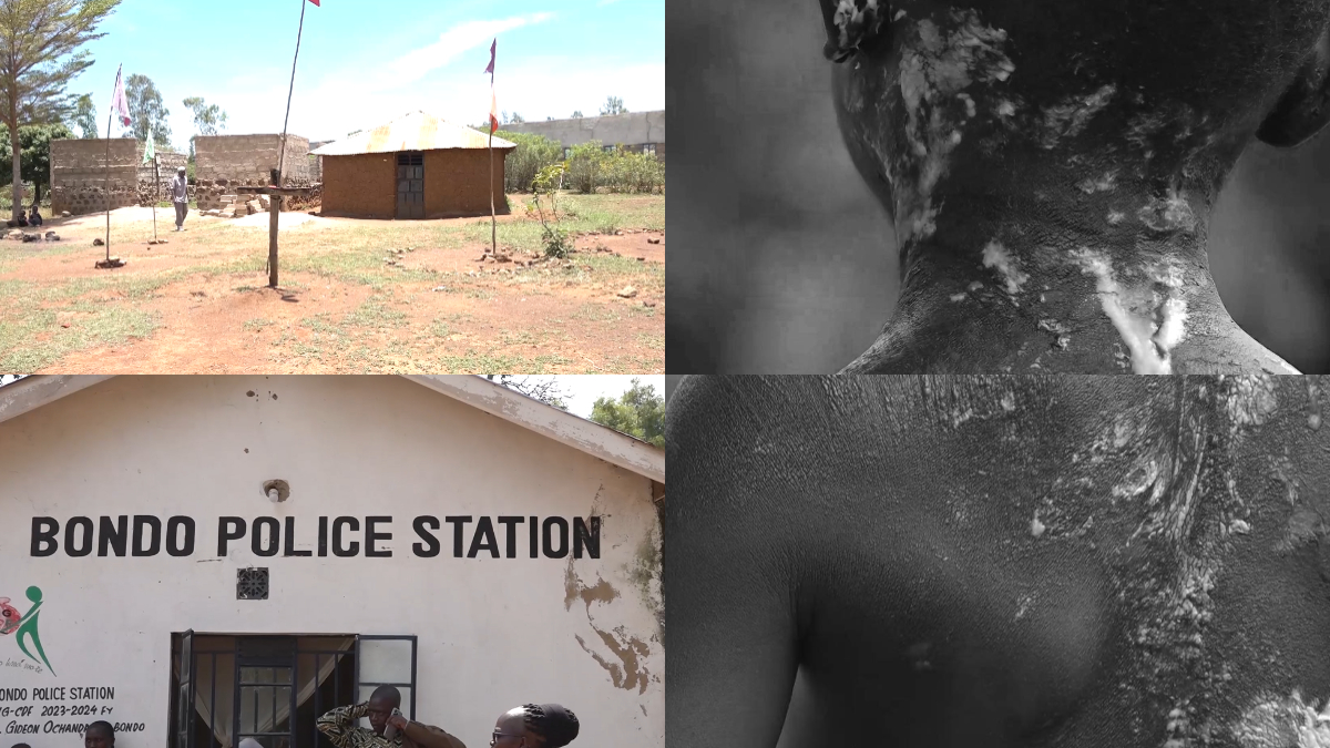 Church closed, four arrested after children burnt with hot water during alleged exorcism ritual