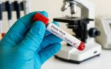 “Remain calm but vigilant” – Ministry says as Kenya confirms second Ebola case