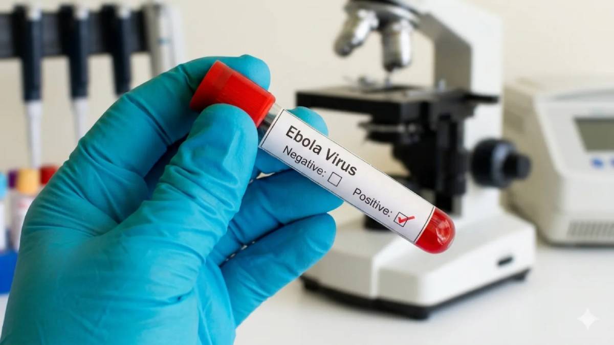 “Remain calm but vigilant” – Ministry says as Kenya confirms second Ebola case