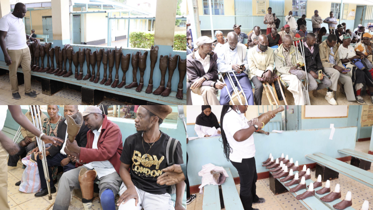 Photos: New lease of life as over 100 amputees walk again after Kitale prosthetics outreach