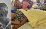 Kitui Teachers College student fighting for her life after macabre attack by lover