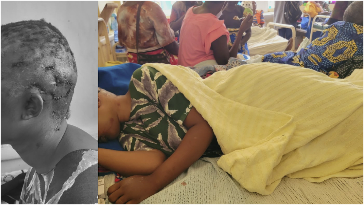 Kitui Teachers College student fighting for her life after macabre attack by lover